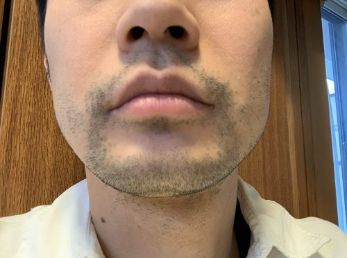 1回目正面