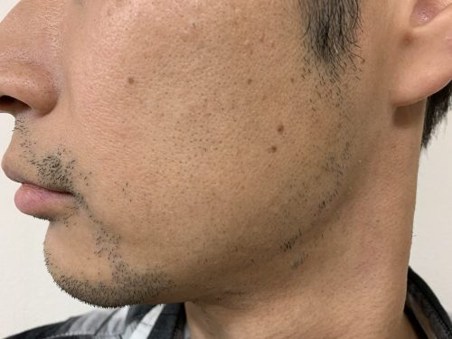 5回目横