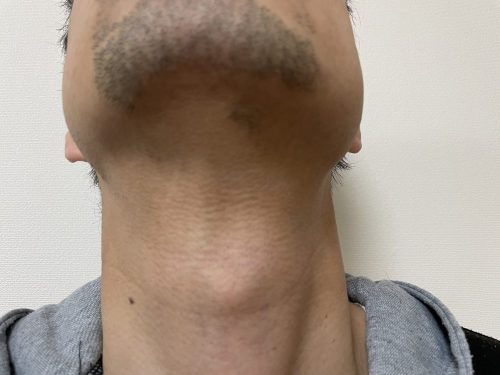 10回目下