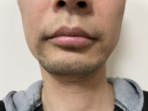 10回目正面