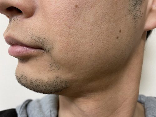 10回目横