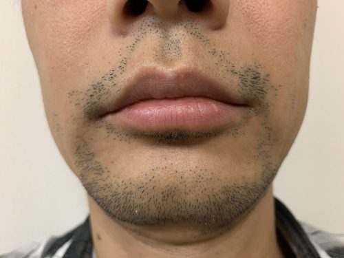 5回目正面